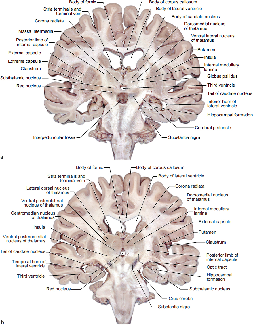 1 Anatomy | Neupsy Key