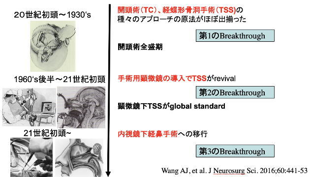 下垂体疾患の手術療法 | 森山脳神経センター病院 山田正三