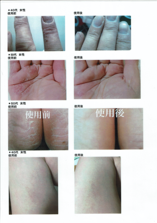 PharmaS1（皮膚トラブルに最適なシコニンクリーム【はな薬局オンライン