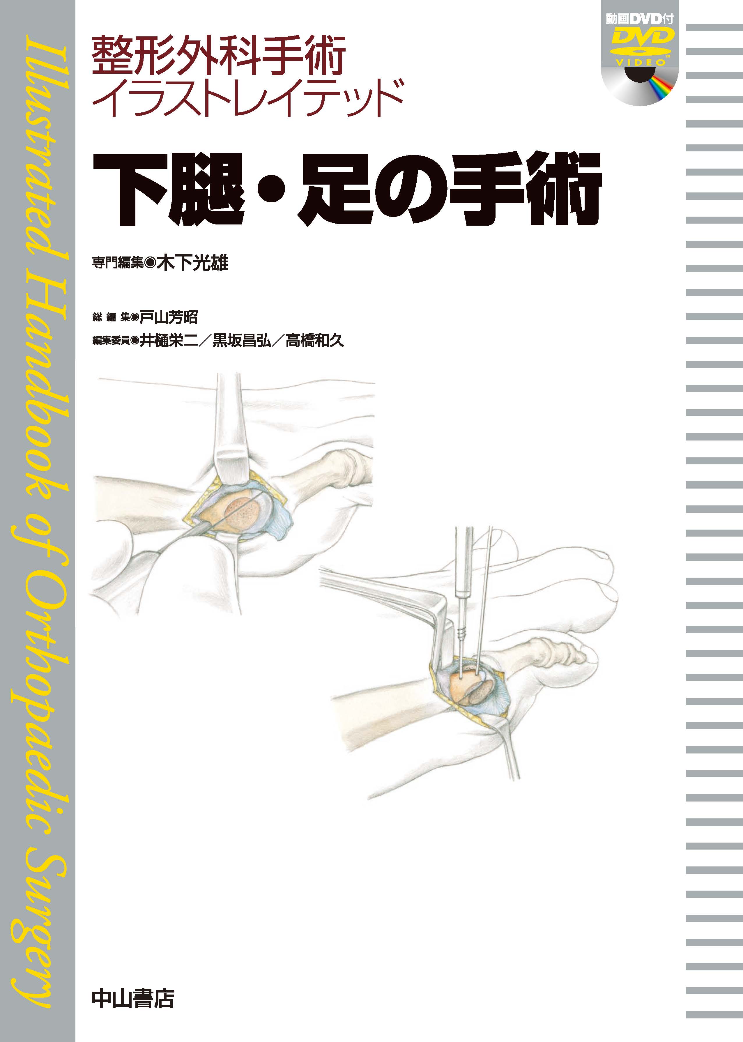 整形外科手術イラストレイテッド 下腿・足の手術 | 神陵文庫