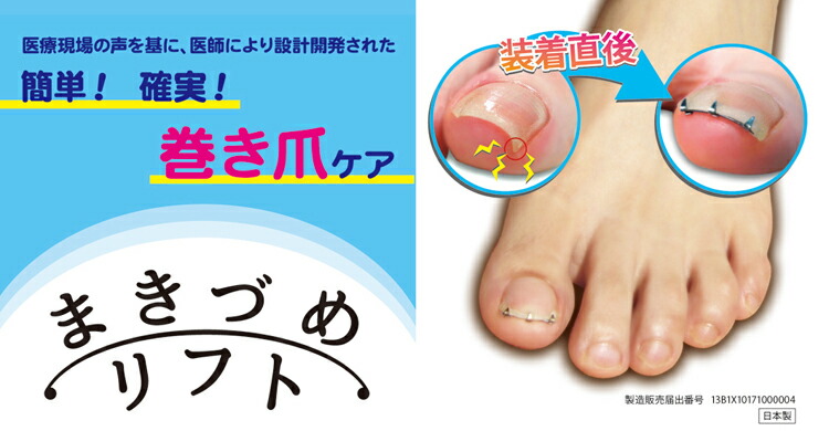 楽天市場】まき爪リフト ＜メール便送料無料＞ まきづめリフト 巻き爪