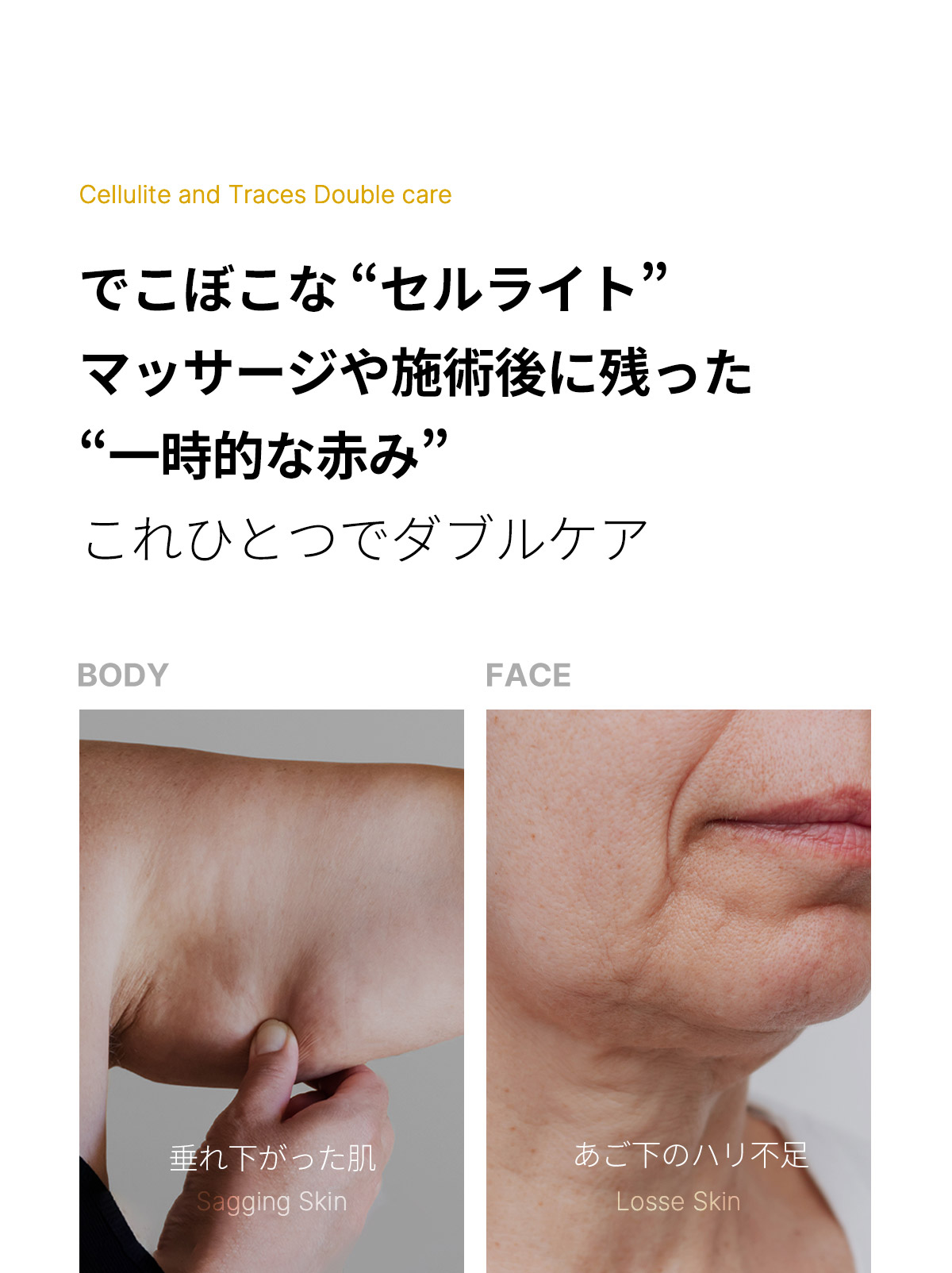 楽天市場】【公式正品】AGE-R ビタKクリーム（ メディキューブ