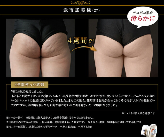 楽天市場】【セール！】 ヤーマン アセチノエレクトロボーテ リポ