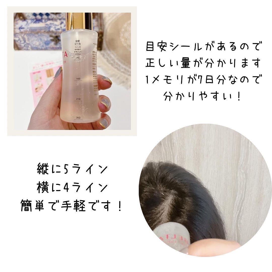 楽天市場】育毛剤 女性 ベルタヘアローション (1本80mL) 医薬部外品