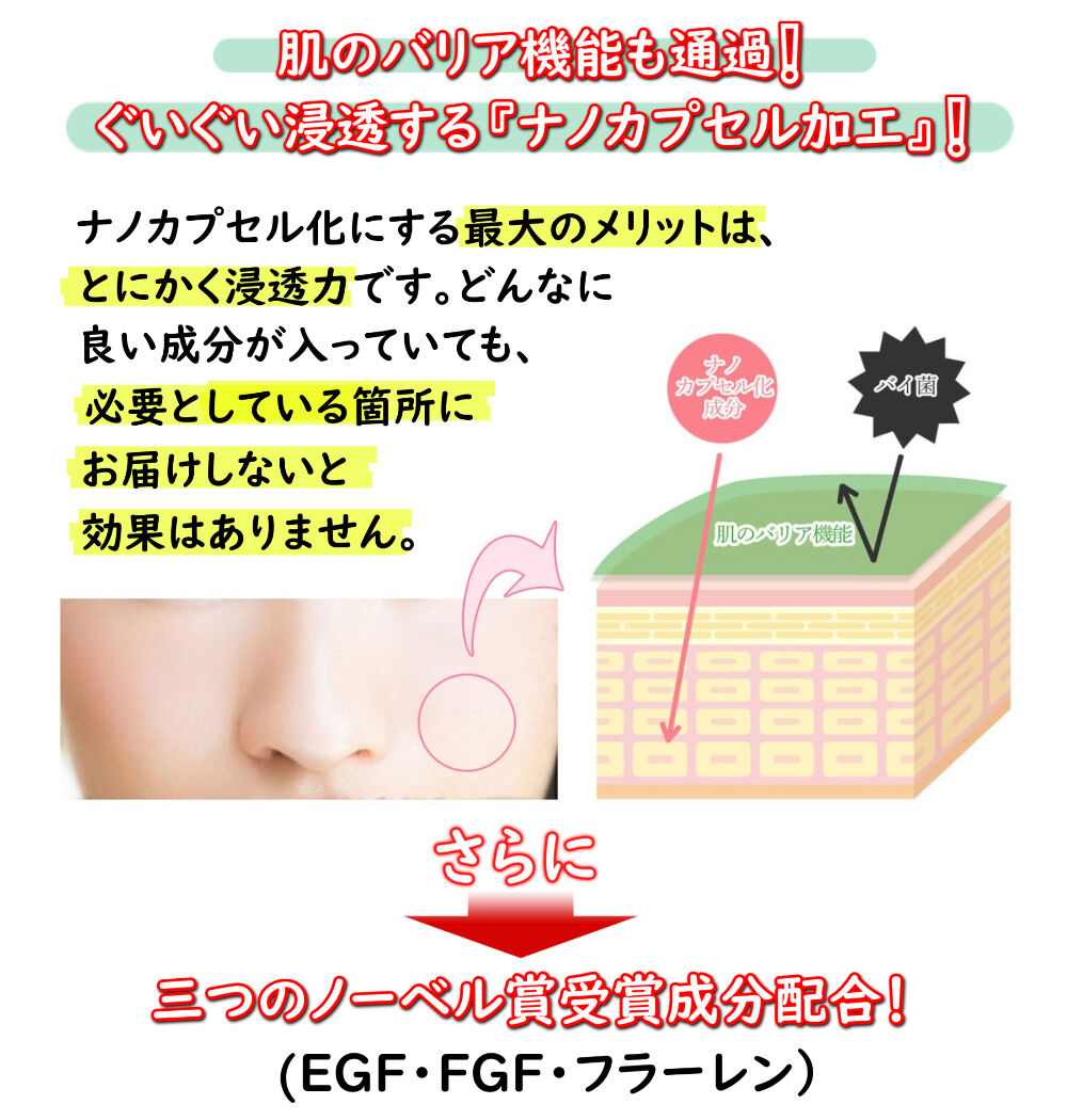 75％OFF！ レイズ ソリューション HC クリーム 30g 臍帯血由来 生