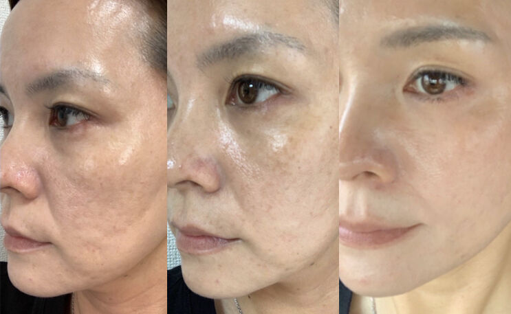 アズイリス炭酸パック 100g | unic's STORE