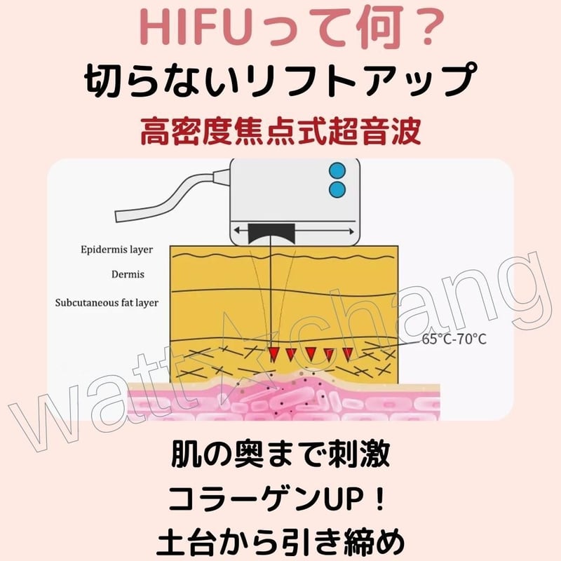 HIFU 超音波美容器 2ヘッド付き 医療HIFU ウルトラフォーマーMPT | ZX