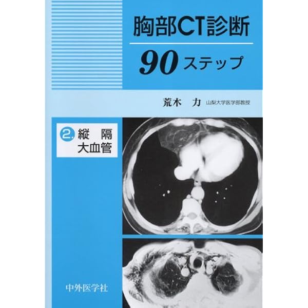 胸部CT診断90ステップ: 肺 (1) | 荒木 力 |本 | 通販 | Amazon
