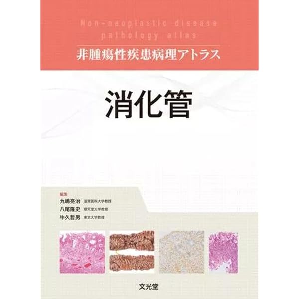 肺 (非腫瘍性疾患病理アトラス) | 蛇澤 晶, 熊坂利夫 |本 | 通販 | Amazon