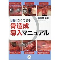 617yJyPntGL._AC_UL210_SR210,