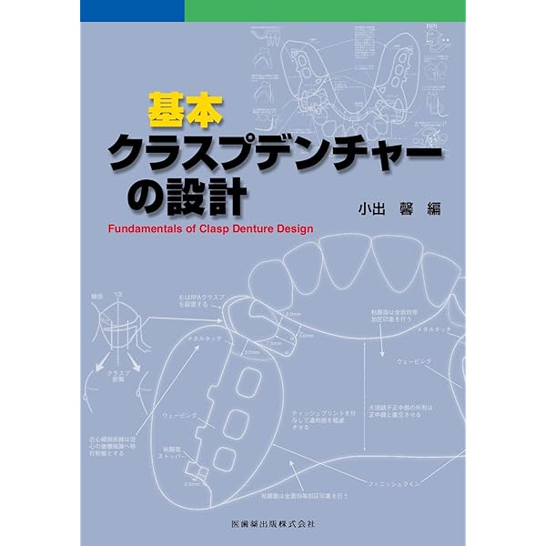 長期症例に学ぶパーシャルデンチャー | 中川 昌樹 |本 | 通販 | Amazon