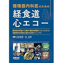 6178yF2iRoL._AC_UL210_SR210,