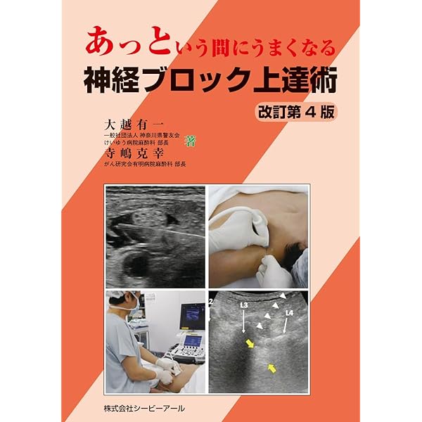 ヘンスレー 心臓手術の麻酔 第5版 | 新見能成, 加藤 剛 |本 | 通販