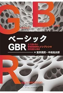 必ず上達 ソケットプリザベーション: インプラント初心者でもできる骨