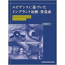 エビデンスに基づいたインプラント治療・骨造成: Early Failure回避の