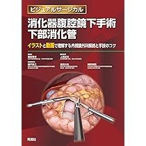 71IpO6EJ1IL._AC_UL210_SR210,