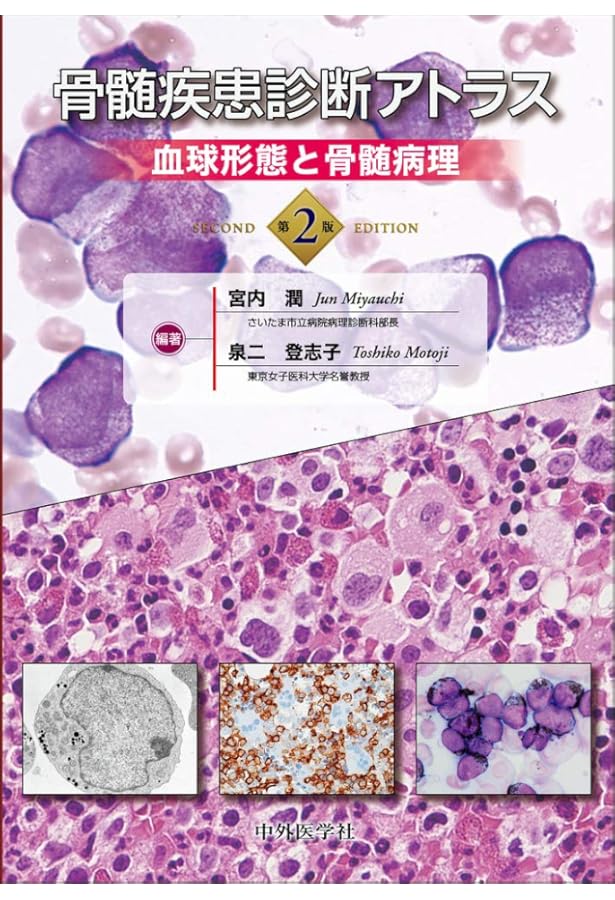 WHO分類第5版による白血病・リンパ系腫瘍の病態学 | 木崎 昌弘, 田丸