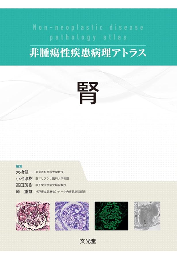 肺 (非腫瘍性疾患病理アトラス) | 蛇澤 晶, 熊坂利夫 |本 | 通販 | Amazon