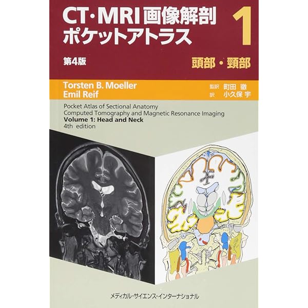 頭頸部のCT・MRI 第3版 | 尾尻博也, 酒井 修 |本 | 通販 | Amazon