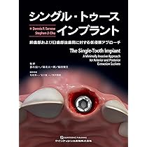 即時治療の真髄: 補綴的要件を達成するための即時埋入と即時負荷