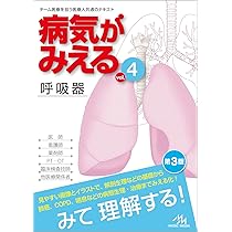 71-R170V25L._AC_UL210_SR210,