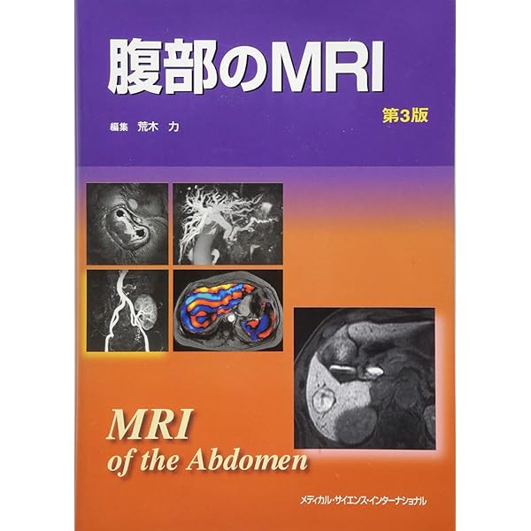 腹部のCT 第3版 | 陣崎雅弘 |本 | 通販 | Amazon