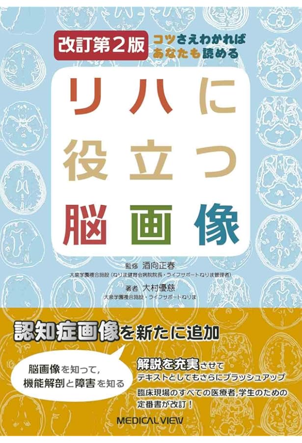 脳の機能解剖と画像診断 第2版 | 眞柳 佳昭 |本 | 通販 | Amazon