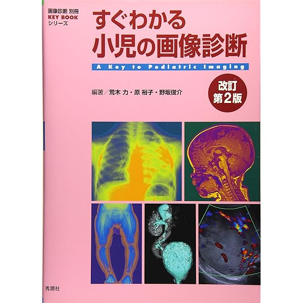 小児神経の画像診断 改訂第2版: ―脳脊髄から頭頸部・骨軟部まで
