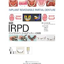新インプラントオーバーデンチャーの基本と臨床 磁性アタッチメントを