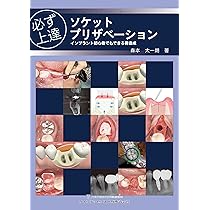 図解! 遅延型吸収性膜を用いた 安全安心GBR | 佐々木 猛 |本 | 通販