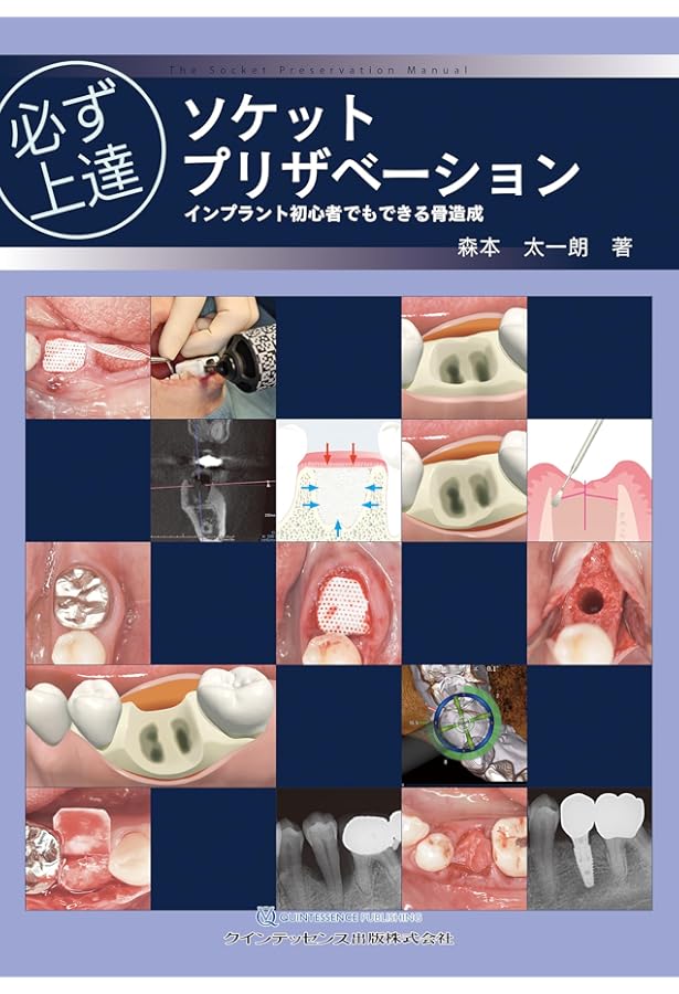 改訂版 インプラント外科: 動画で理解! 基本手技と自家骨移植の