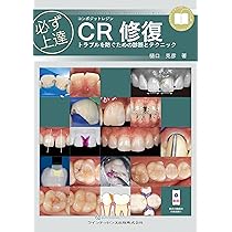 必ず上達 CR(コンポジットレジン)修復: トラブルを防ぐための診断と