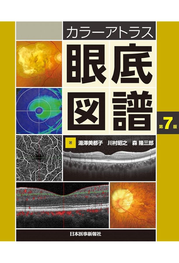 健診のための眼底検査 改訂版〜無散瞳カメラによる撮影と判定〜 (手に
