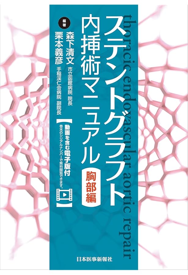 ステントグラフト内挿術マニュアル 腹部編【動画を含む電子版付