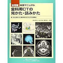 決定版 実践マニュアル 歯科用CTの見かた・読みかた | 森本 泰宏, 金田