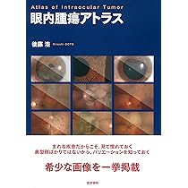 Amazon.co.jp: 眼内腫瘍アトラス : 後藤 浩: 本