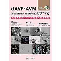 聴神経腫瘍・小脳橋角部腫瘍の手術とマネージメント | 河野 道宏 |本