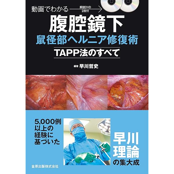 寺島式 静岡がんセンター胃癌手術[Web動画付]: 開腹からロボットまで