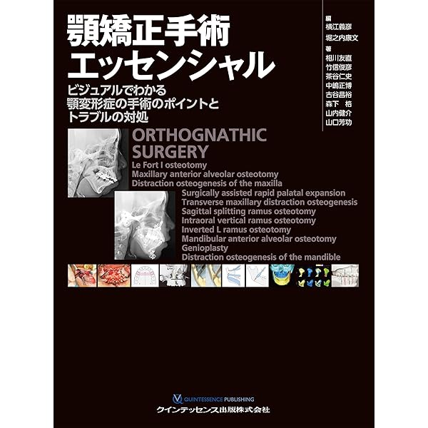 基礎から学ぶデジタル時代の矯正入門: IOSと3Dプリンターを応用した