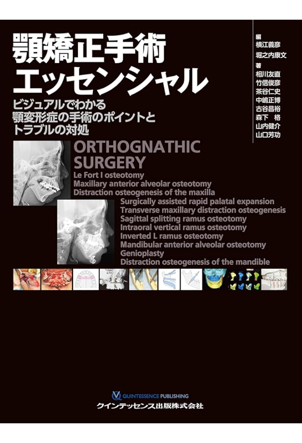顔面骨への手術アプローチ | 下郷 和雄 |本 | 通販 | Amazon
