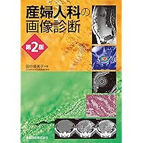産婦人科の画像診断 第2版 | 田中 優美子 |本 | 通販 | Amazon