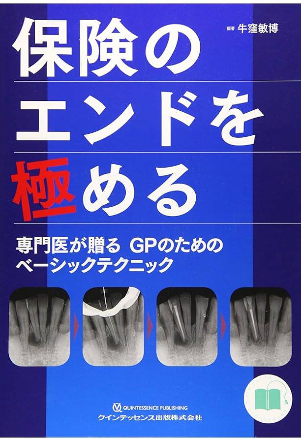 Amazon.co.jp: 必ず上達 抜歯手技 増補新版 (必ず上達シリーズ