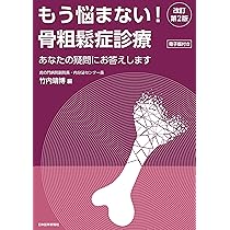 91AIaW3aR9L._AC_UL210_SR210,