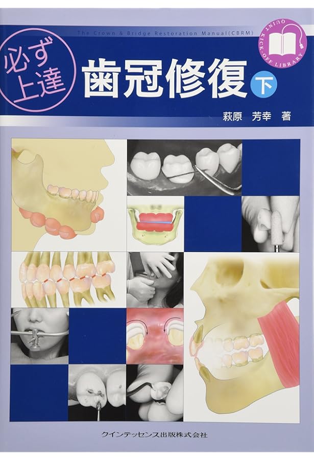 Amazon.co.jp: 必ず上達 歯冠修復(上) : 萩原 芳幸: 本