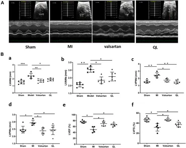 Frontiers | Qiliqiangxin Modulates the Gut Microbiota and NLRP3