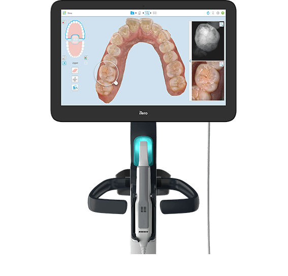 製品・ソリューション | インビザライン・ジャパン