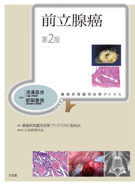 m3電子書籍 | 癌診療指針のための病理診断プラクティス 原発不明癌