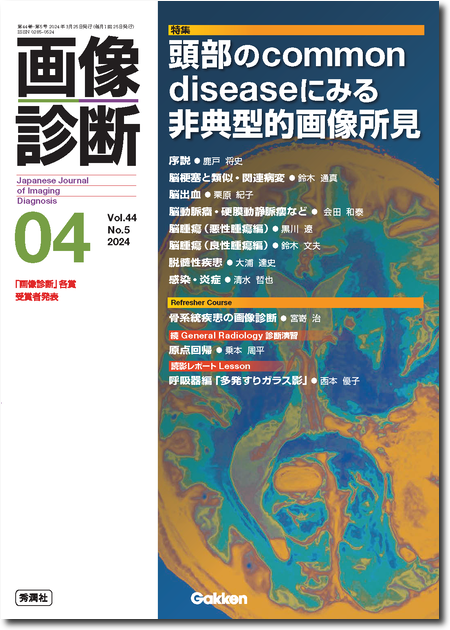 m3電子書籍 | 画像診断 2025年2月号（Vol.45 No.2）エキスパートを