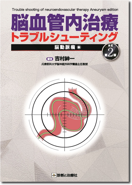 m3電子書籍 | パーフェクトマスター脳血管内治療 必須知識の