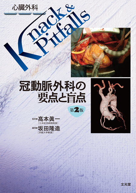 m3電子書籍 | 心臓外科 Knack & Pitfalls 冠動脈外科の要点と盲点 第2版